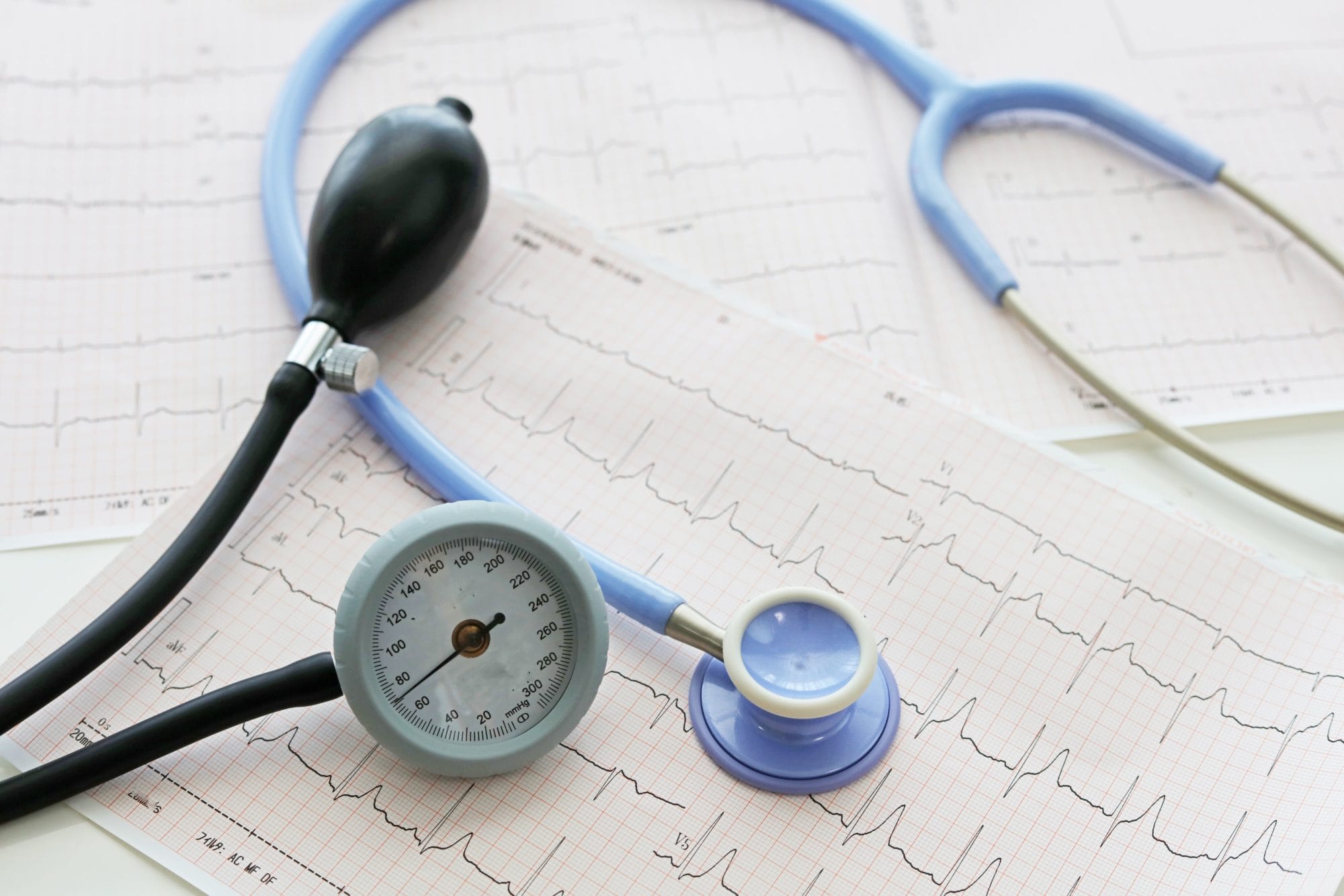 hartfilmpje sportcardiologie sport medisch centrum papendal