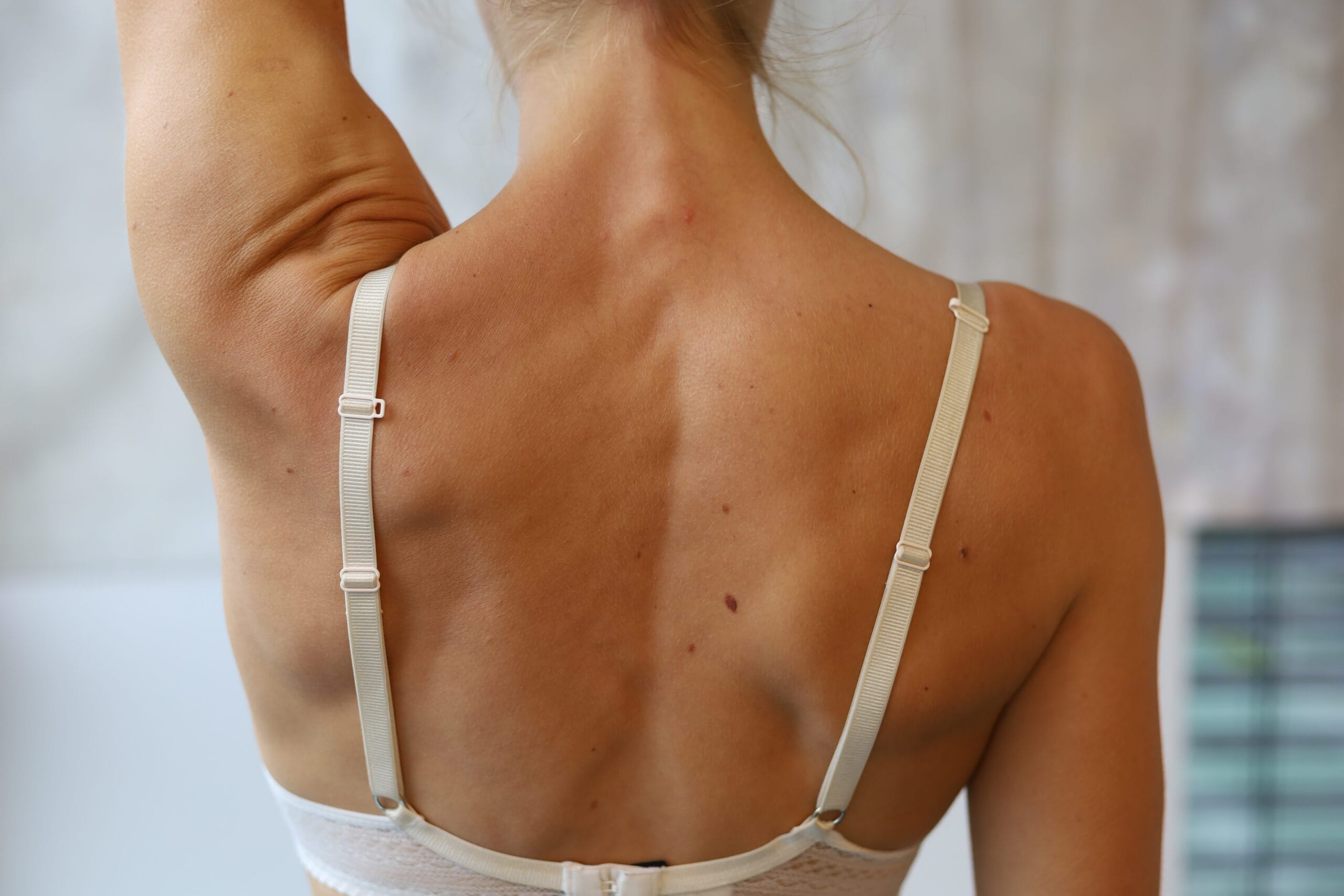 voor behandeling fysiotherapie bij klachten van je bovenrug en schouders moet je naar sport medisch centrum papendal